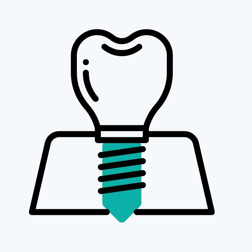 Dental İmplant Teadavisi