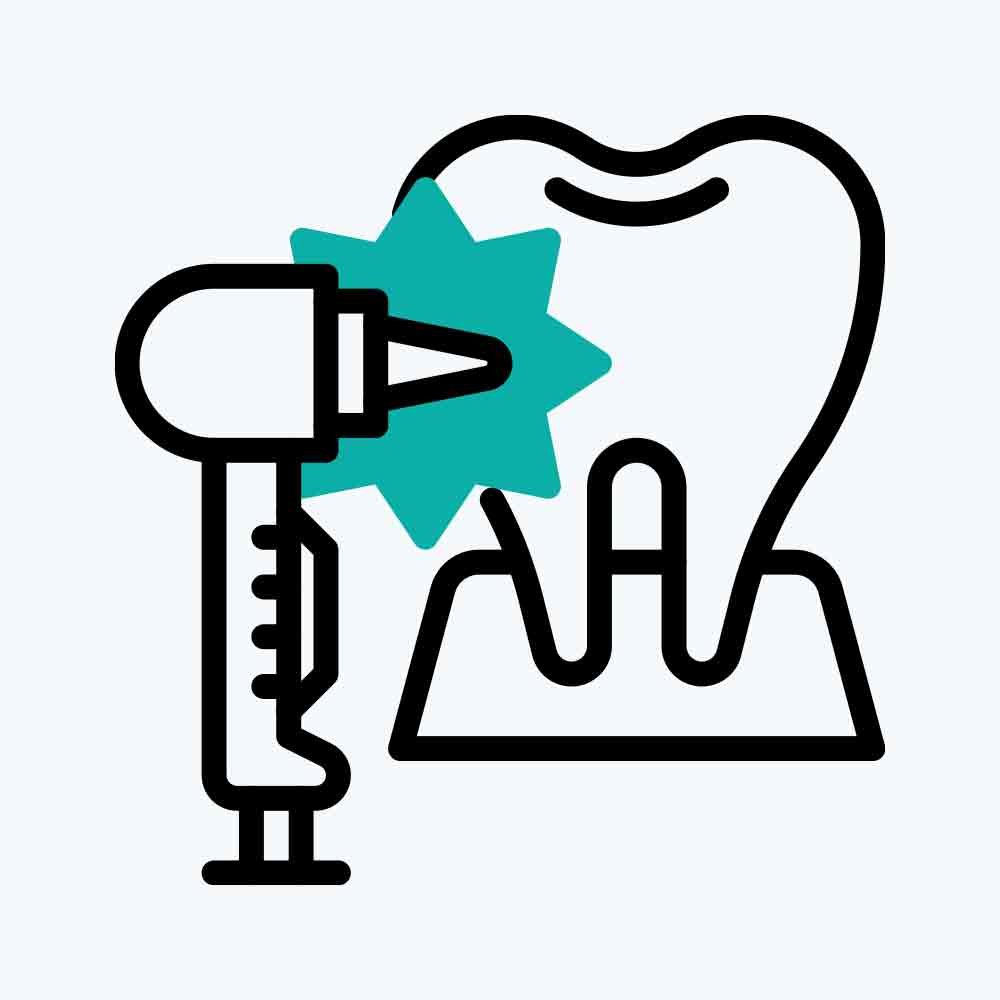 Diş Beyazlatma Uygulaması